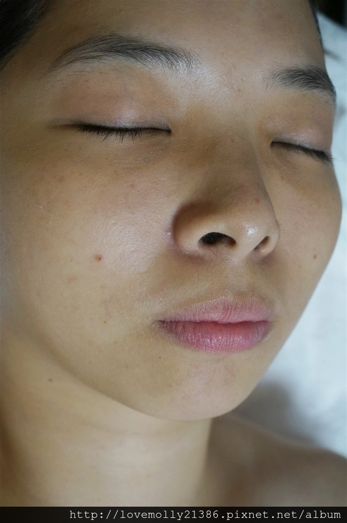 20250816-tkr40