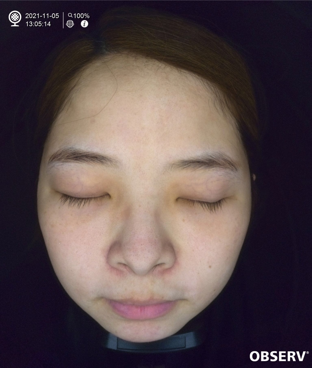 20250817-xf3ct